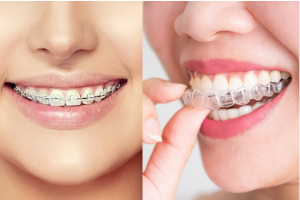 Nha khoa lâu năm niềng răng Thái Bình - Kinh nghiệm tạo nên chất lượng