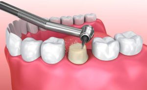 Nha khoa Âu Mỹ Á 75 năm thuộc top 3 cơ sở uy tín nhất Thái Bình