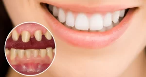 Nha khoa Âu Mỹ Á 75 năm thuộc top 3 cơ sở uy tín nhất Thái Bình