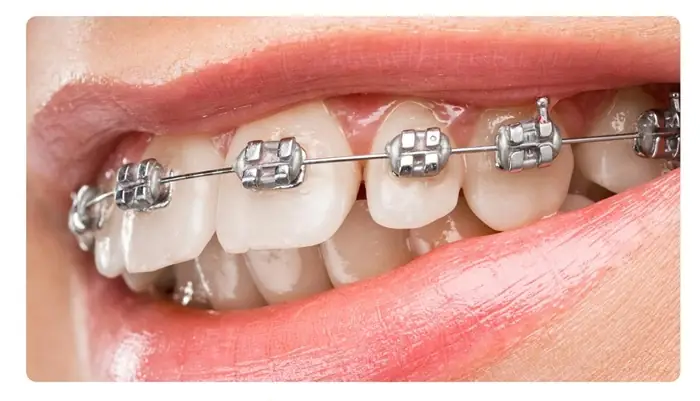 Nha khoa lâu năm niềng răng Thái Bình - Kinh nghiệm tạo nên chất lượng