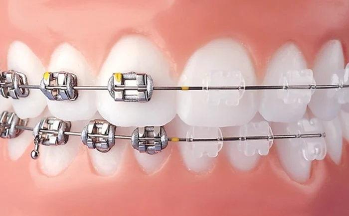 Nha khoa lâu năm niềng răng Thái Bình - Kinh nghiệm tạo nên chất lượng