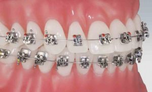 Nha khoa lâu năm niềng răng Thái Bình - Kinh nghiệm tạo nên chất lượng